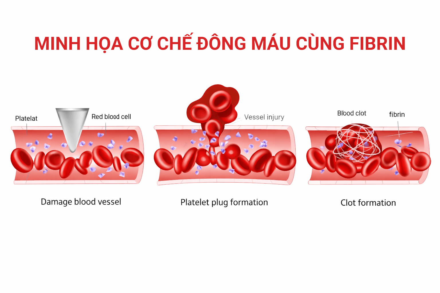 fibrin tao mang luoi 1 - Sản phẩm được bán bởi Gimedi Pharma