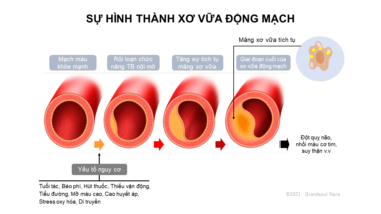 xo vua dogn mach theo thoi gian 1 - Sản phẩm được bán bởi Gimedi Pharma