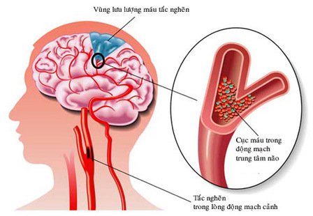 tac nghen mach mau.max 1800x1800 1 - Sản phẩm được bán bởi Gimedi Pharma