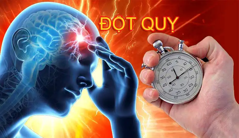 4 lý do dẫn đến đột quỵ