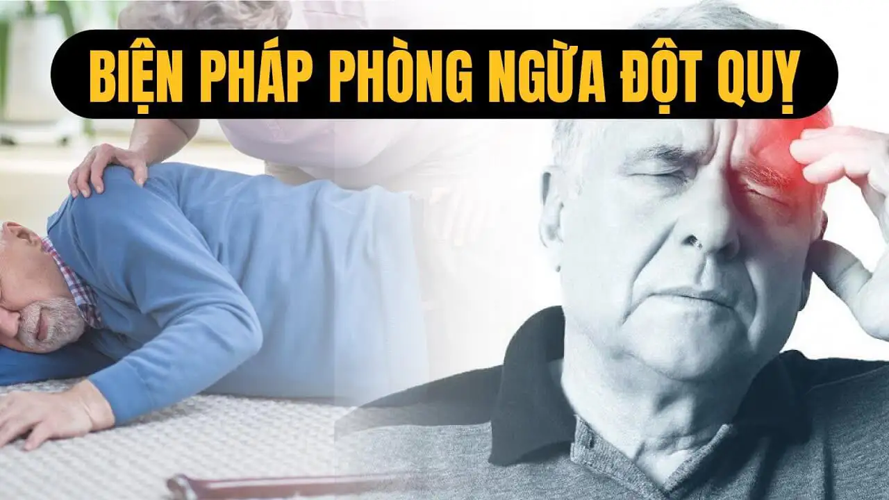  Đột Quỵ: Nguyên Nhân, Triệu chứng và Biện Pháp Phòng Ngừa