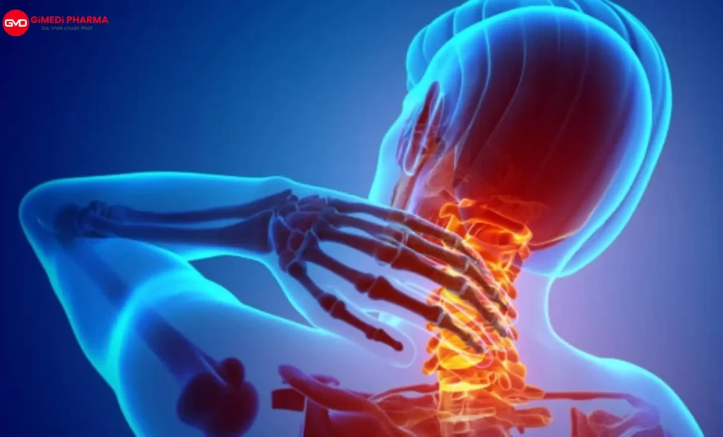 THOÁI HÓA CỘT SỐNG CỔ: ĐIỀU TRỊ CHUẨN CHUYÊN KHOA