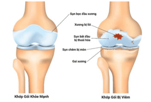 sun khop 1 - Sản phẩm được bán bởi Gimedi Pharma