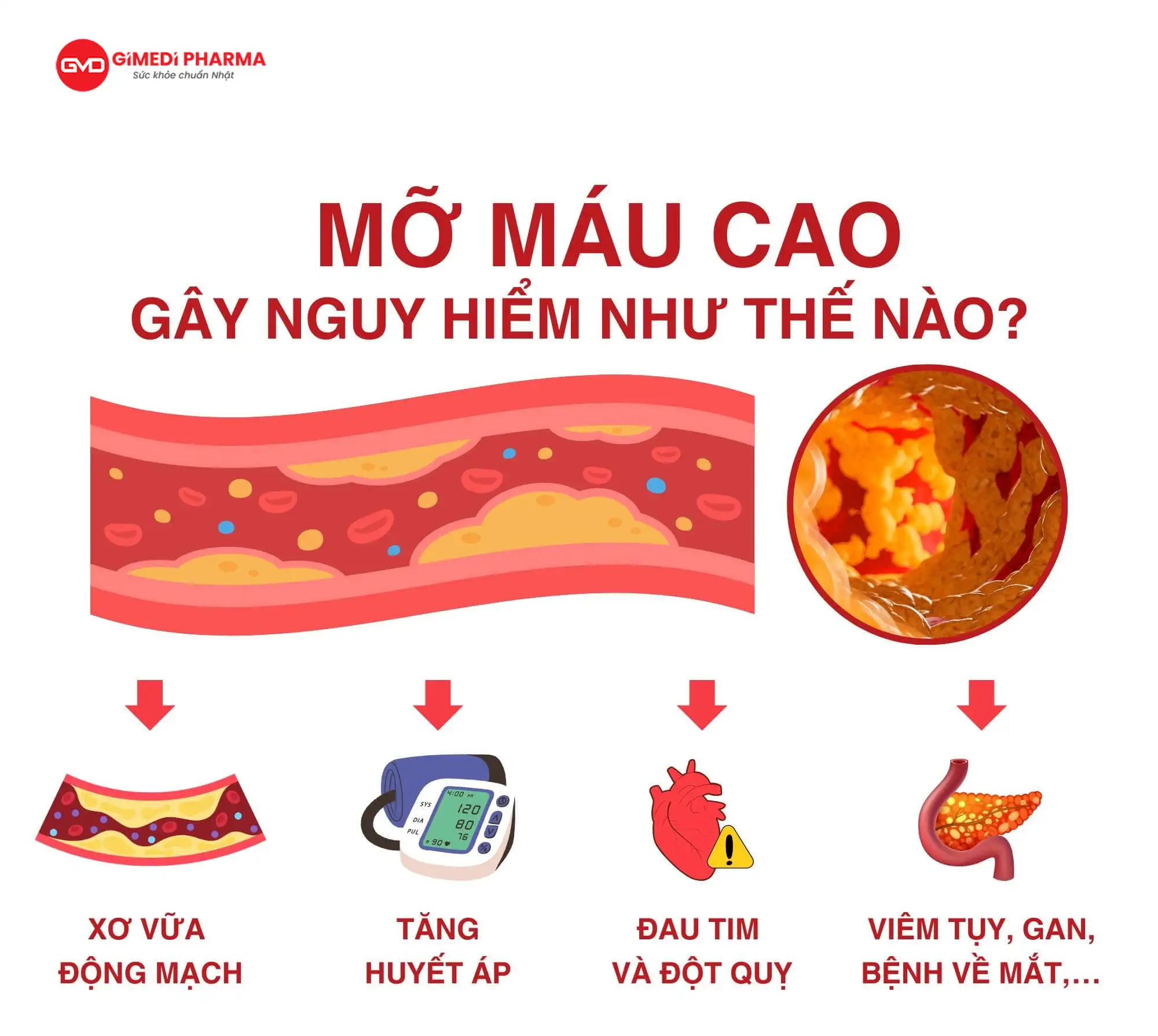 mỡ máu cao gây nguy hiểm (1)